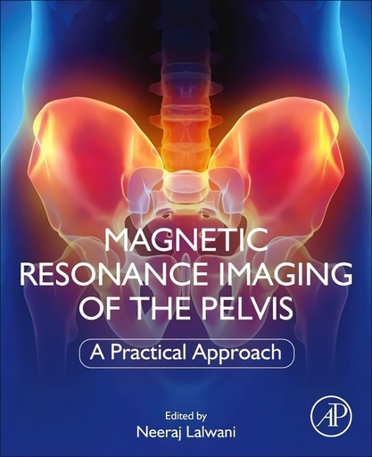 [9780323898546] Magnetic resonance imaging of the pelvis