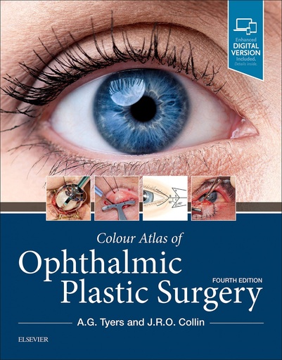 [9780323476799] Colour Atlas of Ophthalmic Plastic Surgery