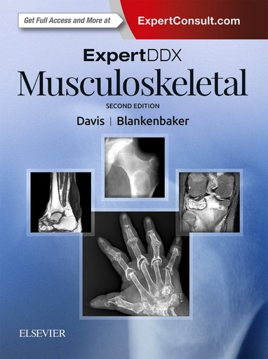 [9780323524834] ExpertDDx: Musculoskeletal