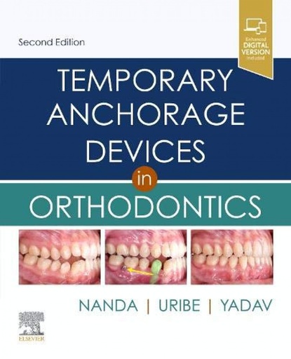 [9780323609333] Temporary anchorage devices in orthodonitcs