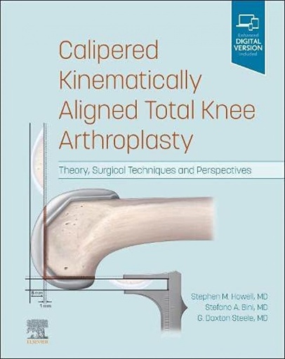 [9780323756266] Calipered kinematically aligned total knee arthroplasty