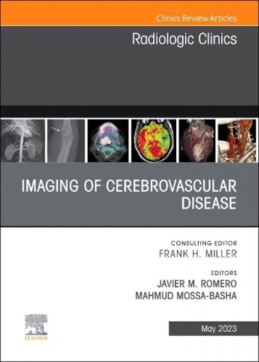 [9780323940092] Imaging of cerebrovascular disease, an issue of radiologic