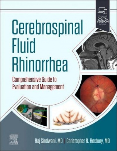 [9780323870726] Cerebrospinal fluid rhinorrhea