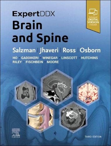 [9780443106941] EXPERTDDX:BRAIN AND SPINE