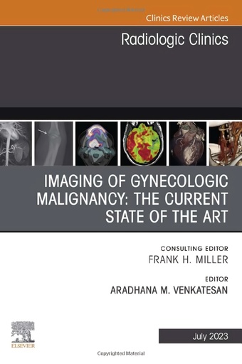 [9780323940351] Imaging of gynecologic malignancy: the current state of the