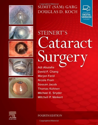 [9780323568111] Steinert´s cataract surgery