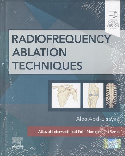 [9780323870634] Radiofrequency ablation techniques