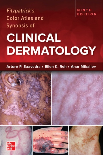 [9781264278015] Fitzpatrick´s Color Atlas and Synopsis of Clinical Dermatology, Ninth Edition