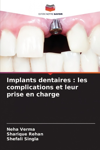 [9786205760260] Implants dentaires