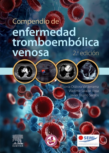 [9788413824277] COMPENDIO DE ENFERMEDAD TROMBOEMBOLICA VENOSA 2ª ED