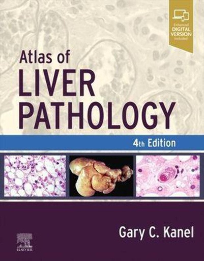 [9780323825337] Atlas of liver pathology