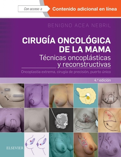 [9788491131120] CIRUGÍA ONCOLÓGICA DE LA MAMA