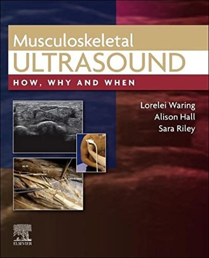 [9780702081989] Musculoskeletal ultrasound