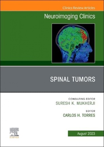 [9780323938679] SPINAL TUMORS, AN ISSUE OF NEUROIMAGING CLINICS OF NORTH