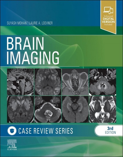 [9781455774852] Brain imaging:case review series