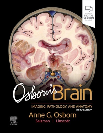 [9780443109379] OSBORN´S BRAIN 3RD.EDITION