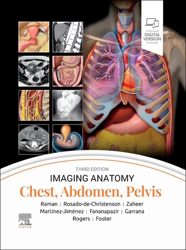 [9780443118005] IMAGING ANATOMY:CHEST,ABDOMEN,PELVIS