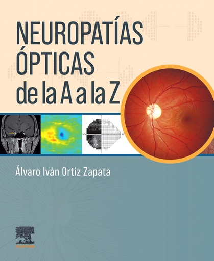 [9788413822952] Neuropatías ópticas de la A a la Z