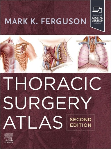 [9780323930222] Thoracic surgery atlas