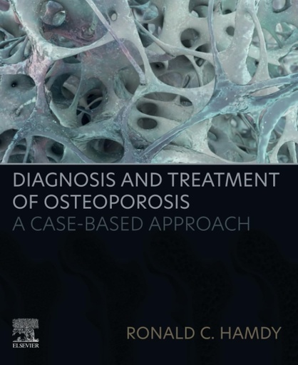 [9780323995504] Diagnosis and treatment ofosteoporosis