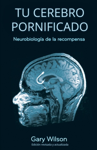 [9780993161650] Tu Cerebro Pornificado