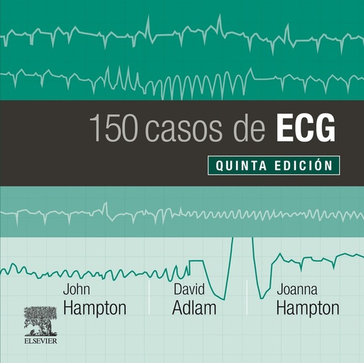 [9788491135043] 150 CASOS DE ECG