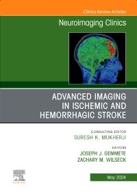 [9780443131332] Advanced imaging in ischemic and hemorrhagic stroke