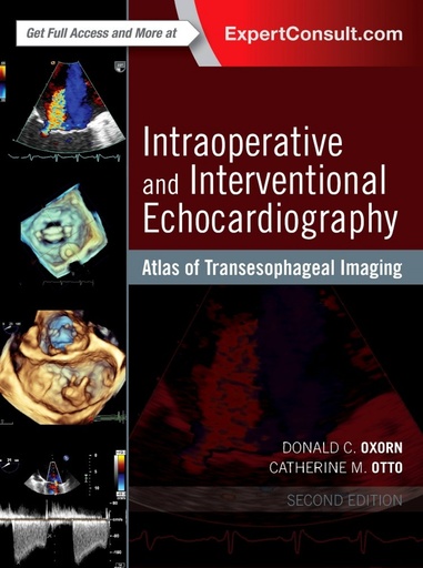 [9780323358255] Intraoperative and Interventional Echocardiography