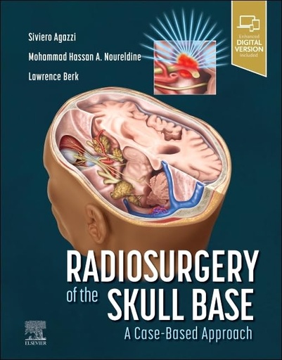 [9780323874373] RADIOSURGERY OF THE SKULL BASE:A CASE BASED APPROACH