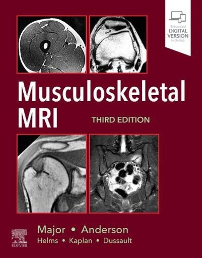 [9780323415606] Musculoeskeletal mri