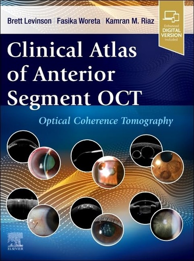 [9780443120466] Clinical atlas of anterior segment oct:optical coherence